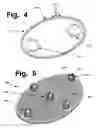 Fig. 04 - ANCHORING SYSTEMS AND INTERFACES FOR FLEXIBLE SURGICAL IMPLANTS  FOR  REPLACING CARTILAGE