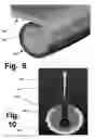 Fig. 06 - ANCHORING SYSTEMS AND INTERFACES FOR FLEXIBLE SURGICAL IMPLANTS  FOR  REPLACING CARTILAGE