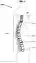 Fig. 06 - Artificial spinal disc replacement system and method