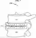 Fig. 08 - Artificial spinal disc replacement system and method