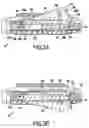 Fig. 04 - Intervertebral disk prosthesis provided with anchor means