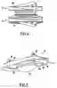 Fig. 05 - Intervertebral disk prosthesis provided with anchor means