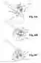 Fig. 04 - Apparatus and method for supporting vertebral bodies