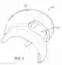 Fig. 02 - ARTHROPLASTY DEVICE