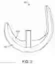 Fig. 03 - ARTHROPLASTY DEVICE