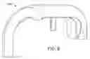 Fig. 09 - ARTHROPLASTY DEVICE