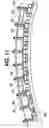 Fig. 09 - Conformal vacuum cup apparatus and method