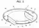 Fig. 04 - Rotary angle detecting device