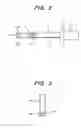 Fig. 03 - Equipment for measuring gas flow rate having an adjacent external surface protrusion