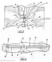 Fig. 03 - Ignition source adapted for positioning within a combustion chamber