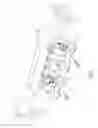 Fig. 02 - Intake manifold for an internal combustion engine provided with metallic reinforcement brackets for fastening the fuel common rail