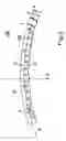 Fig. 04 - Synchronising Ring For A Synchronising Apparatus, A Friction Lining Blank And Also A Method For The Manufacture Of A Synchronising Ring