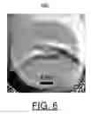 Fig. 08 - Use of a focusing vortex lens as the objective in spiral phase contrast microscopy