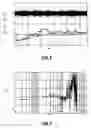 Fig. 07 - Automated sensor signal matching