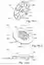 Fig. 11 - Single or multiple stage blower and nested volute(s) and/or impeller(s) therefor