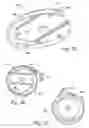 Fig. 29 - Single or multiple stage blower and nested volute(s) and/or impeller(s) therefor