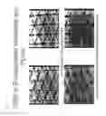 Fig. 10 - Transdermal sustained release drug delivery