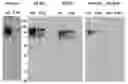 Fig. 01 - DIAGNOSTIC MARKERS FOR CANCER