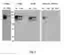 Fig. 02 - DIAGNOSTIC MARKERS FOR CANCER