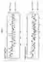Fig. 04 - IL-12 for expression in mammalian cell