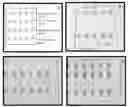 Fig. 01 - DETECTION OF NUCLEIC ACID BIOMARKERS USING POLYMERIZATION-BASED AMPLIFICATION