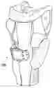 Fig. 01 - Passage expansion device for patients