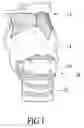 Fig. 02 - Passage expansion device for patients