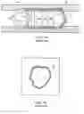 Fig. 02 - DIAGNOSTIC CAPSULE WITH PERIPHERAL IMAGING