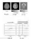 Fig. 07 - Method for magnetic resonance spectroscopic imaging