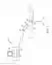 Fig. 02 - Use of micro and miniature position sensing devices for use in TKA and THA