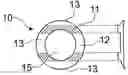Fig. 01 - Control of myopia using contact lenses