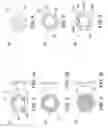 Fig. 02 - Control of myopia using contact lenses