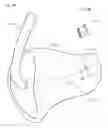 Fig. 09 - Ear mold