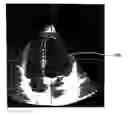Fig. 01 - IMAGING SYSTEM