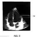 Fig. 03 - IMAGING SYSTEM
