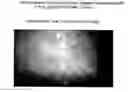 Fig. 01 - In vivo detection of apoptosis
