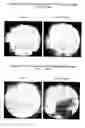 Fig. 02 - In vivo detection of apoptosis