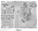Fig. 04 - DENDRITIC CELLS