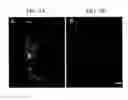 Fig. 06 - Methods of treatment by administering anti-connexin proteins and mimetics