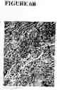 Fig. 22 - Method of increasing trafficking of endothelial progenitor cells to ischemia-damaged tissue