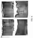 Fig. 09 - Organ regeneration device