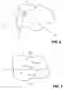 Fig. 06 - Selective resonance of chemical structures