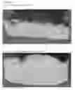 Fig. 05 - Aerated fat-continuous products