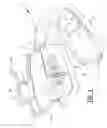 Fig. 02 - ORTHODONTIC DEVICE