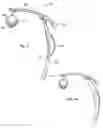 Fig. 02 - ILLUMINATION SYSTEM FOR DENTISTRY APPLICATIONS