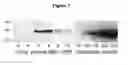 Fig. 02 - METHOD FOR THE EARLY DETECTION OF RENAL INJURY