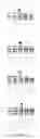 Fig. 14 - Discovery, Cloning and Purification of Thermococccus sp. (Strain 9 Degrees N-7) Dna Ligase