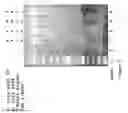 Fig. 15 - Discovery, Cloning and Purification of Thermococccus sp. (Strain 9 Degrees N-7) Dna Ligase