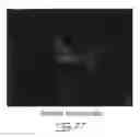 Fig. 35 - Multipotent stem cells from peripheral tissues and uses thereof