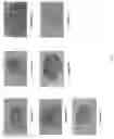 Fig. 02 - Stem cell separating material and method of separation